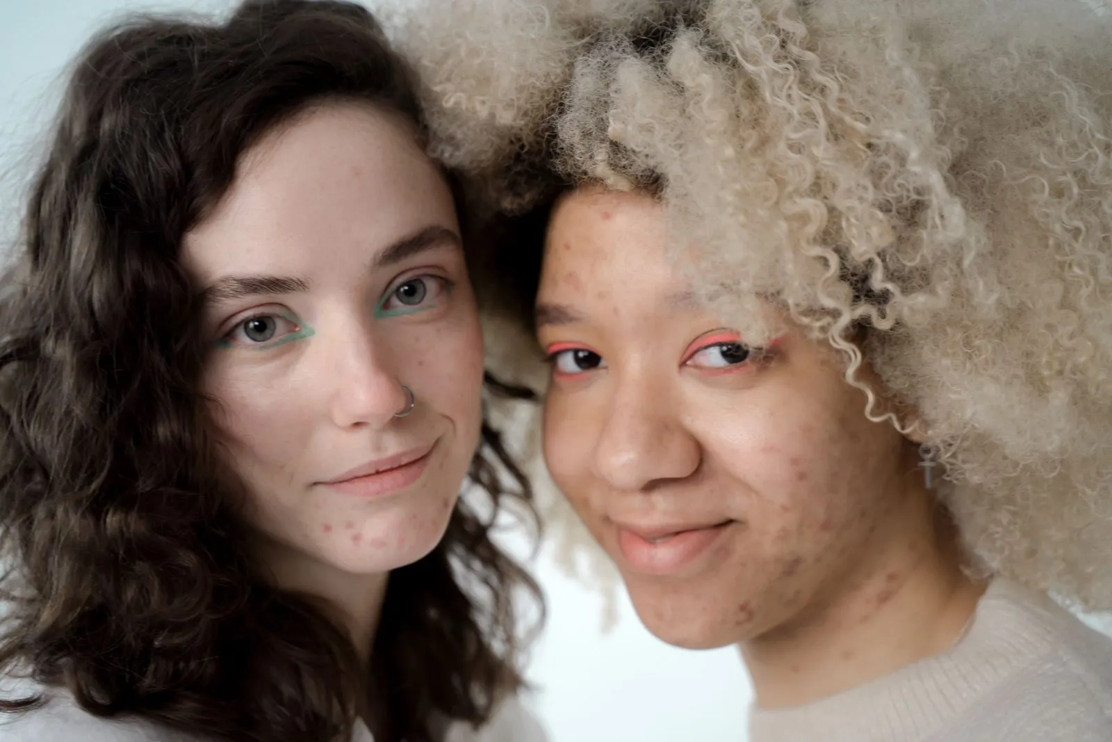 Acne Treatment: Understanding the PCOS Connection